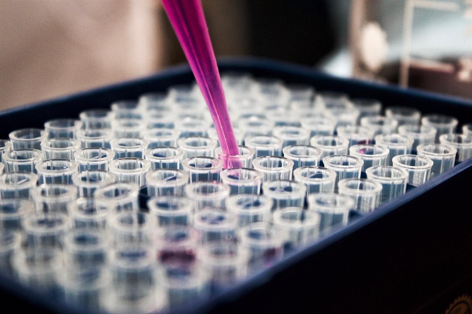 A tray of test tubes in a lab